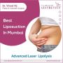  Discover the Best Liposuction in Mumbai with Dr. Vinod Vij