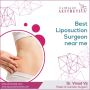 Transform Your Body: Discover the Top Liposuction Surgeon 