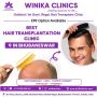 Transform Your Look: Premier Hair Transplant Clinic